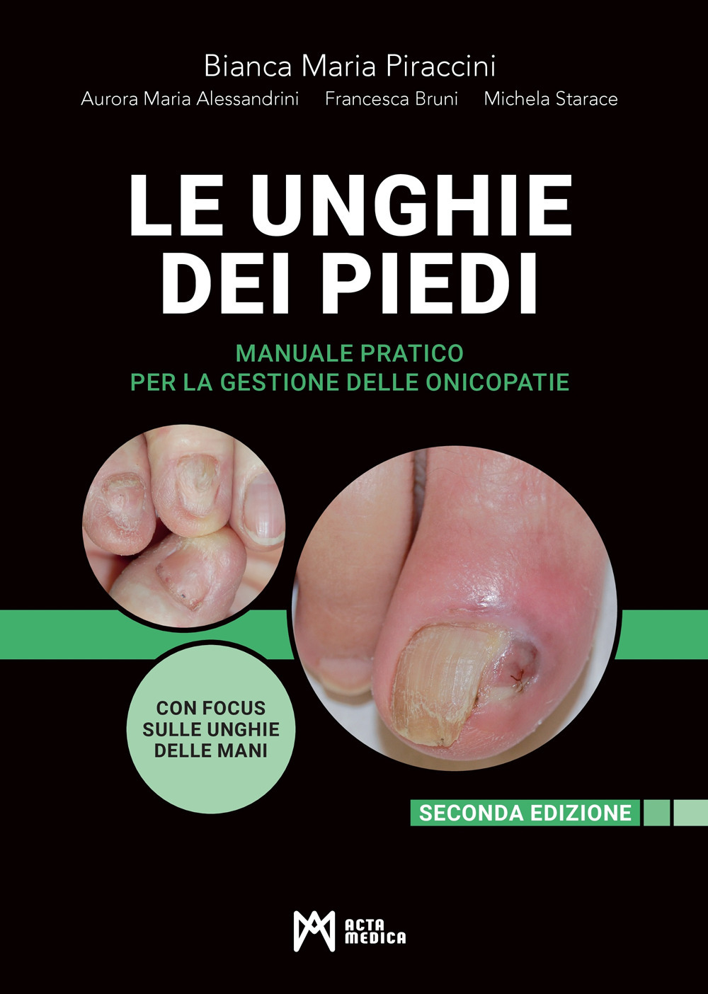 Le unghie dei piedi. Manuale pratico per la gestione delle onicopatie