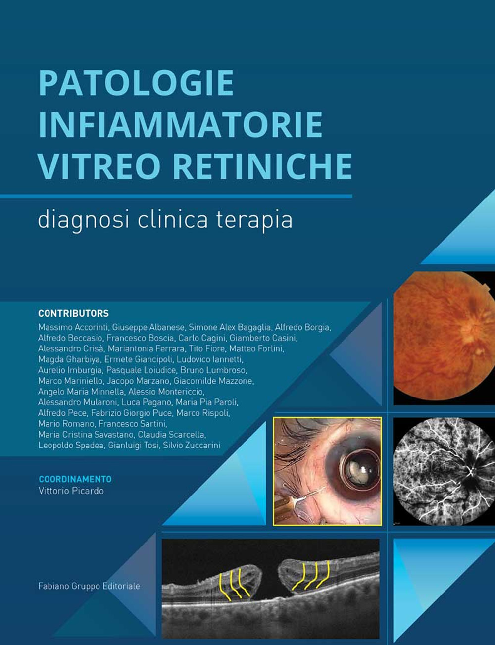 Patologie infiammatorie vitreo-retiniche. Diagnosi, clinica, terapia
