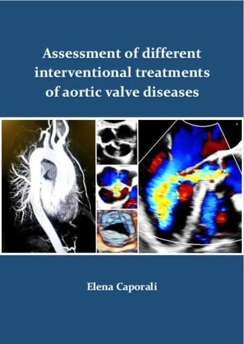 Assessment of different interventional treatments of aortic valve diseases