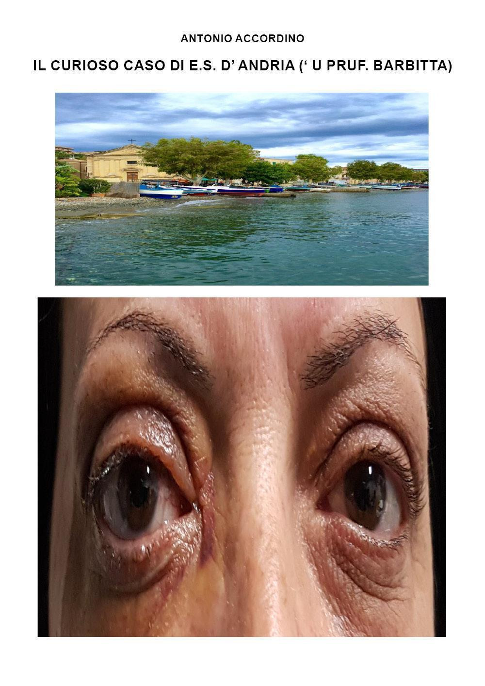 Il curioso caso di E. S. D'Andria ('u Pruf. Barbitta)