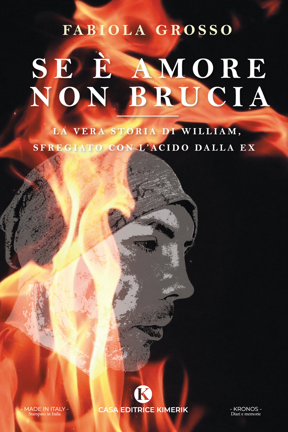 Se è amore non brucia. La vera storia di William, sfregiato con l'acido dalla ex