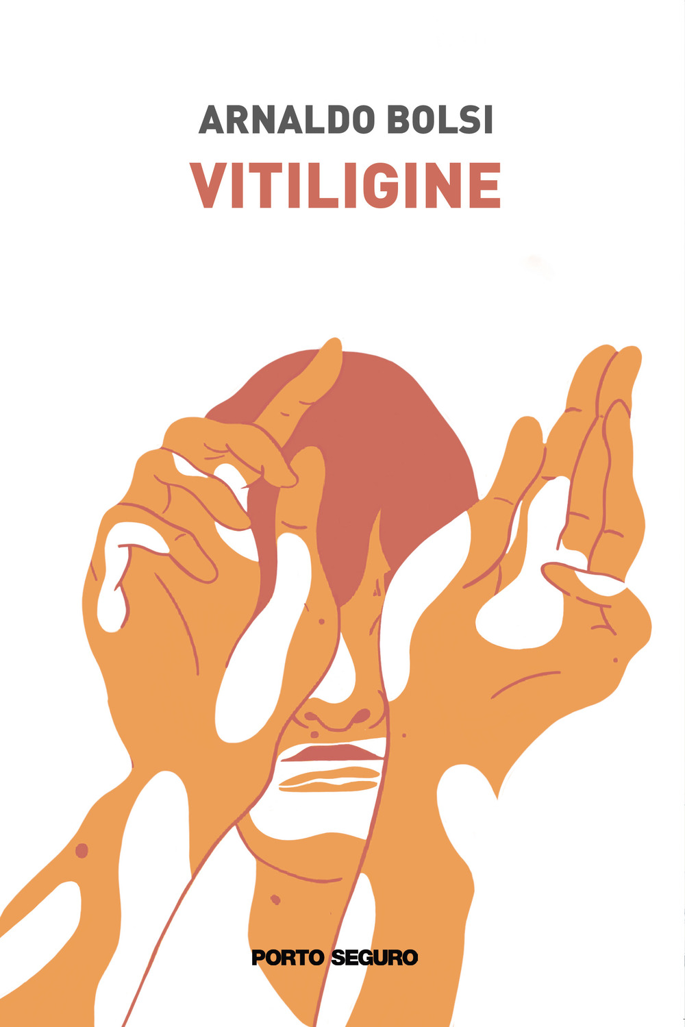 Vitiligine