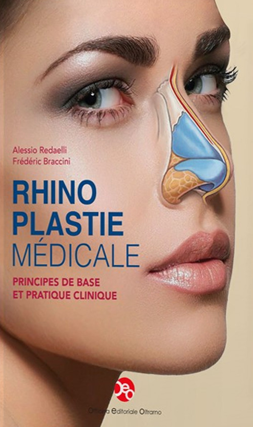 Rhinoplastie médicale. Principes de base et pratique clinique