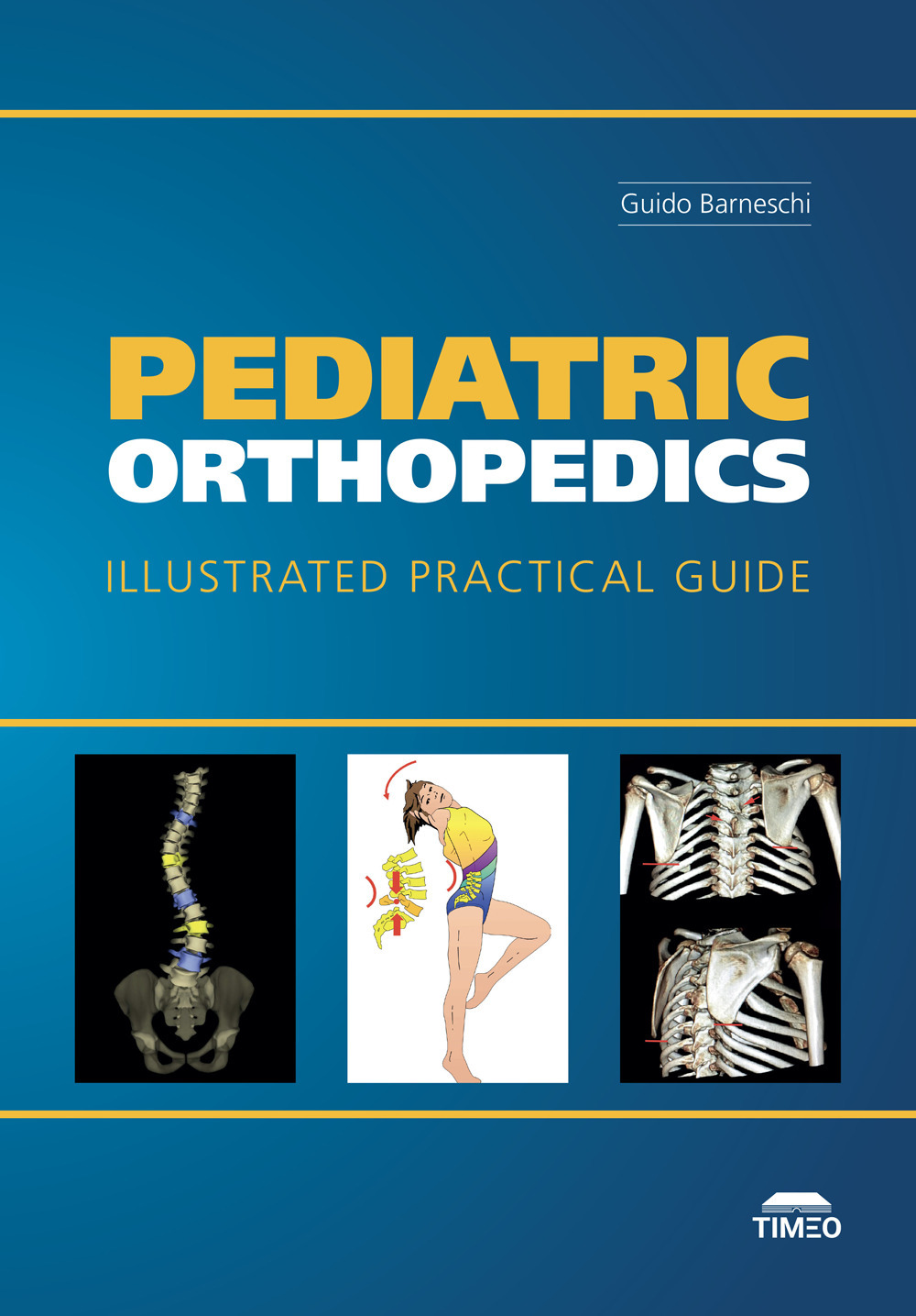 Pediatric Orthopedics. Illustrated Practical Guide